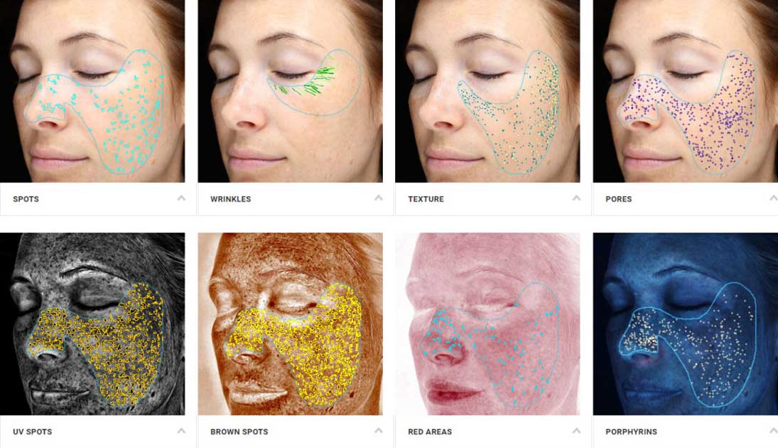 Complexion Analysis Scan with the VISIA system showing 8 photos.