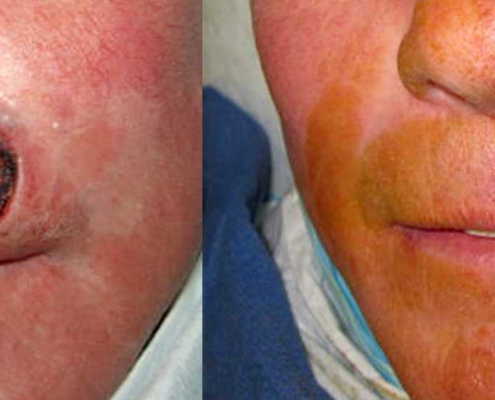 Before & After Facial Surgery Photo