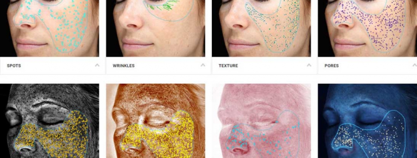 Complexion Analysis Scan with the VISIA system showing 8 photos.